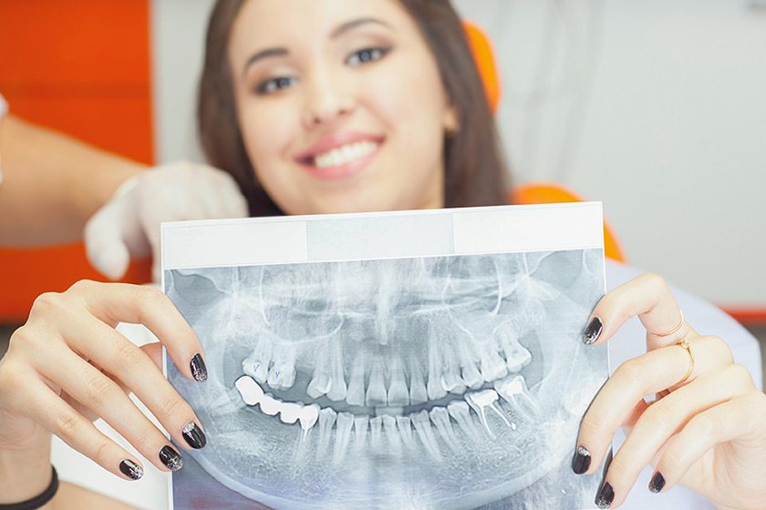 Kemik Grefti Nedir? – İmplant Kemik Tozu Uygulaması