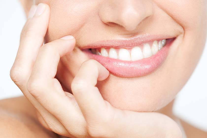 Prepless (Aşındırmasız) Veneer Uygulama Aşamaları
