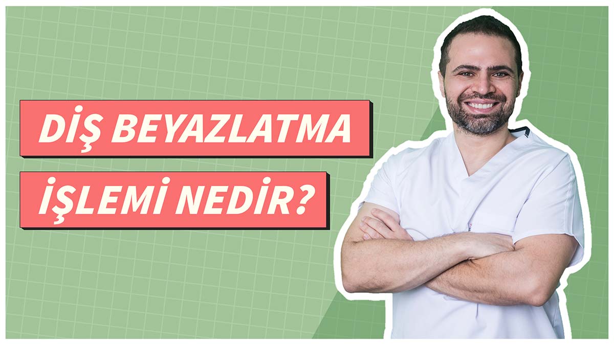 Diş Beyazlatma İşlemi Nedir? Diş Beyazlatma Nasıl Yapılır?