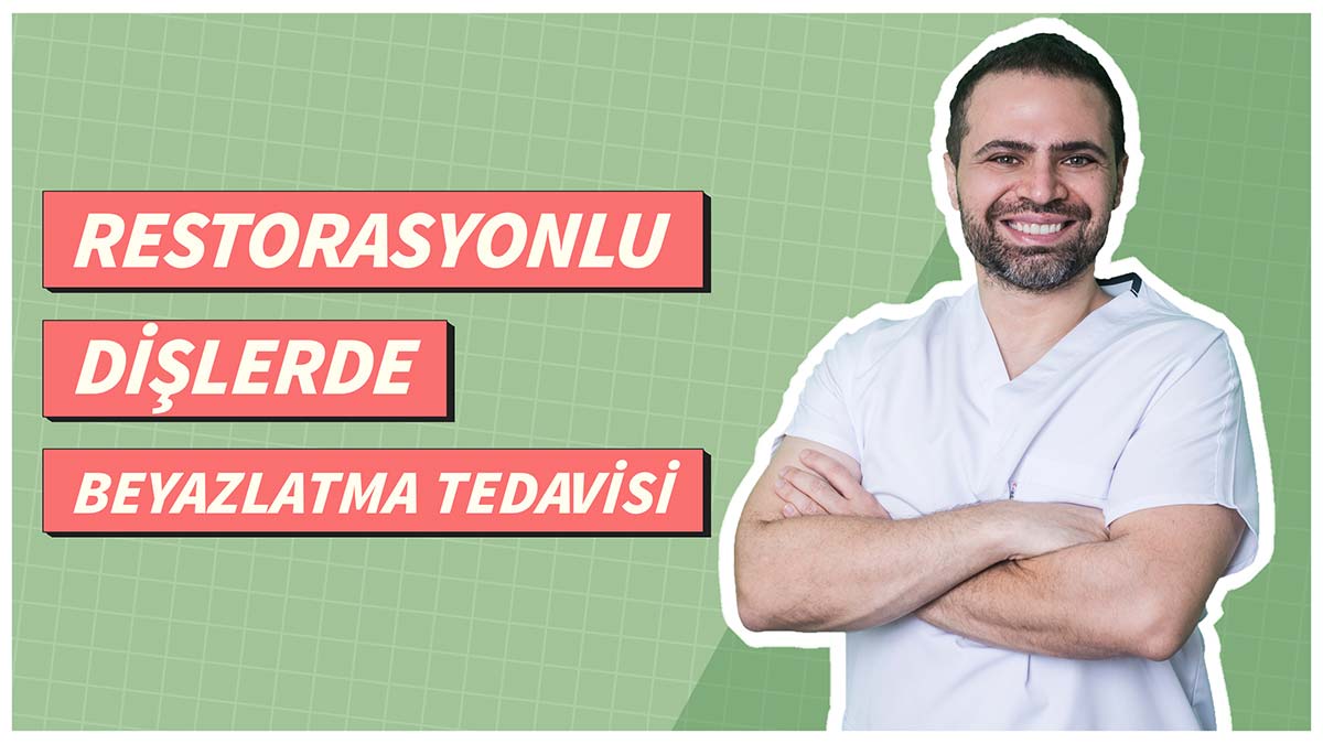 Restorasyonlu Dişlerde Beyazlatma (Bleaching) Tedavisi