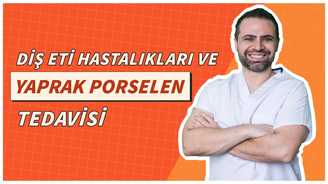 Diş Eti Hastalıkları ve Yaprak Porselen Tedavisi