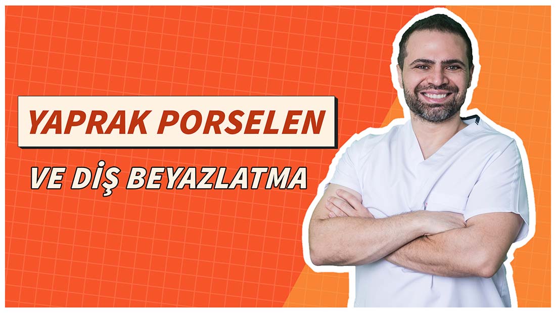 Yaprak Porselenler ve Diş Beyazlatma