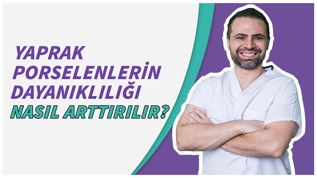 Yaprak Porselenlerin Dayanıklılığı Nasıl Arttırılır?