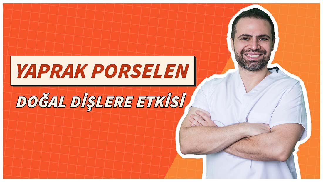 Yaprak Porselenlerin Doğal Dişlere Etkisi Nasıldır?